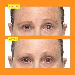 C-Firma™  Fresh Day Serum  - C Vitamini Serumu